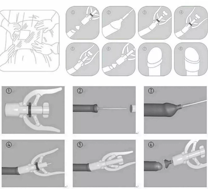 Disposable Circumcision Staplers 8