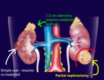 Urología - Parte 2